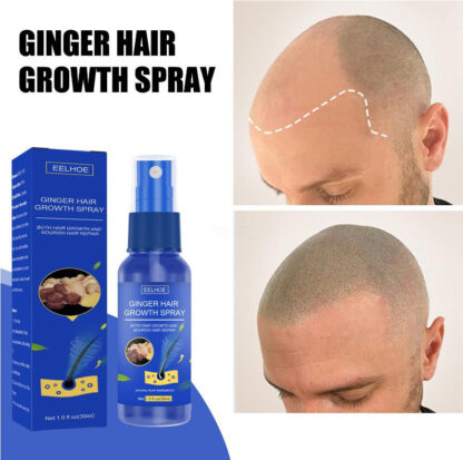 EELHOE Hair Growth Spray Official Website 7 days EELHOE Germinal Oil ...